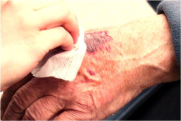 夢見小腿肉里長蟲子是什麼意思_周公解夢官網