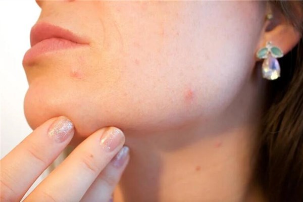 夢見身上長斑什麼寓意_周公解夢