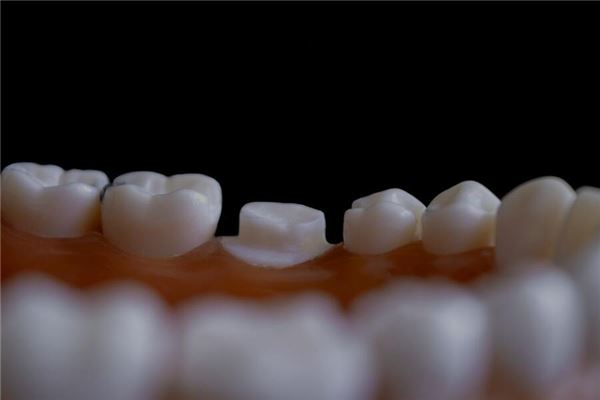 夢見斷牙意味著什麼_周公解夢