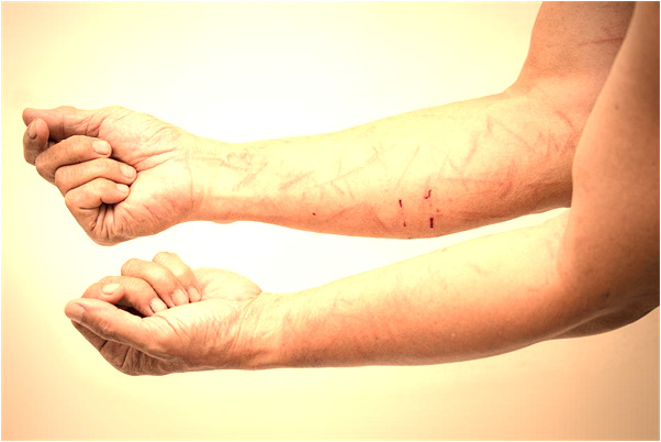 夢見床頭上有好多蛆蟲爬出怎么說_周公解夢官網