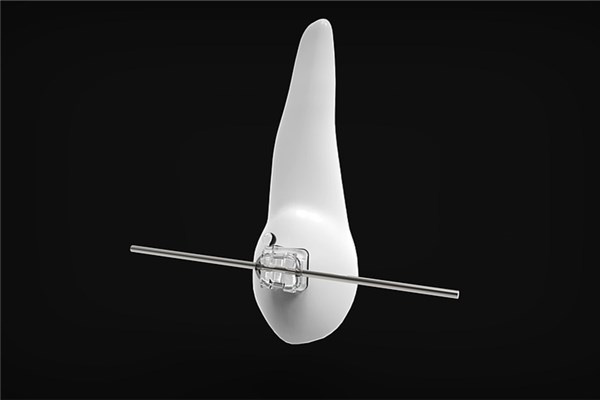 夢到門牙斷預兆了什麼嗎_周公解夢