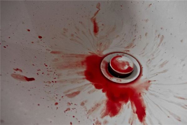 懷孕夢見流血見紅_周公解夢