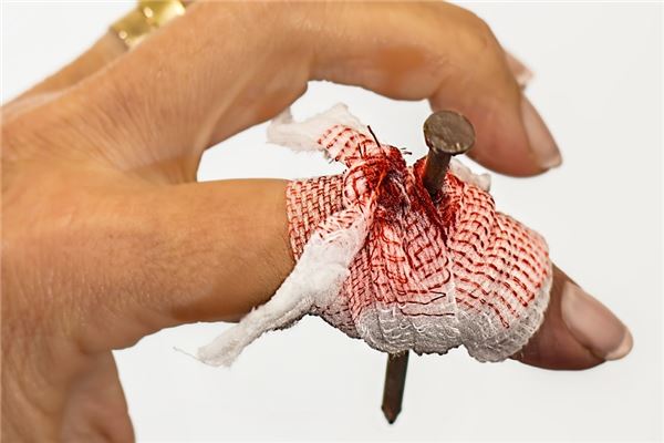 夢到了老公手受傷會怎麼樣_周公解夢