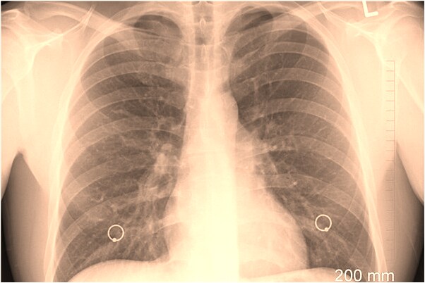 夢到了與親人團聚是怎么回事_周公解夢官網