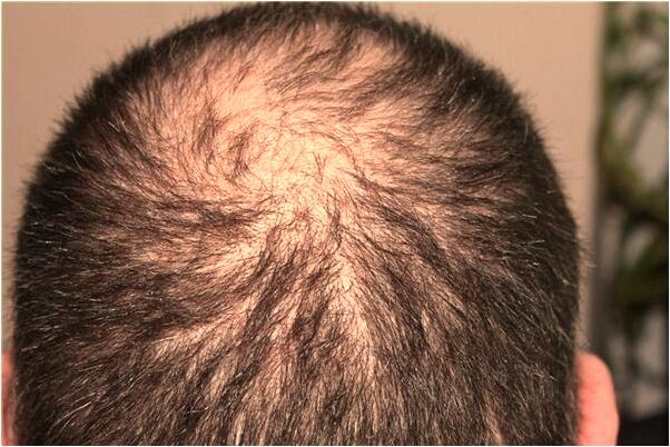 夢見把貓埋在田裡是凶兆還是吉兆_周公解夢官網