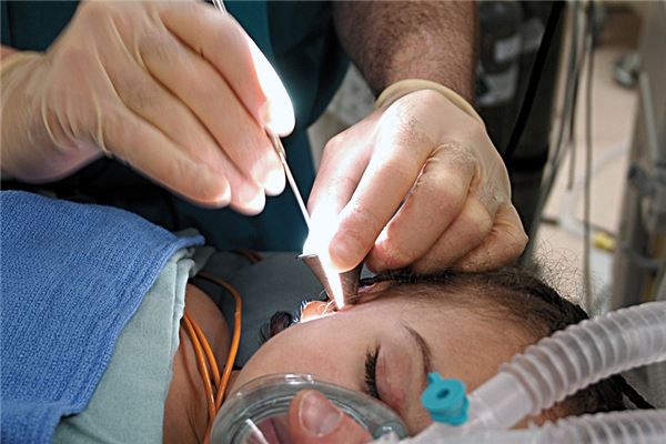 夢到了耳朵流濃是什麼意思_周公解夢