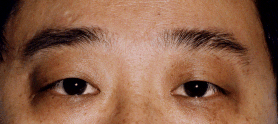 Physiognomy analysis: 6, stop ─ in the eye and eyebrow _ to visit fortune-teller accomplishment