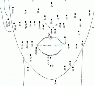 Women fate facial nevus phase diagram