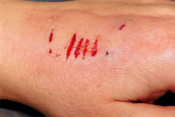 夢到看到血會有什麼預兆_周公解夢