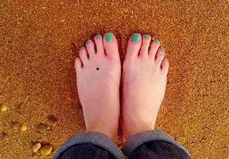 What graphical toes have a nevus represent
