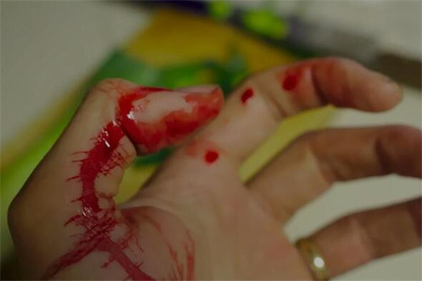 夢見自己被蛇咬傷會怎麼樣_周公解夢