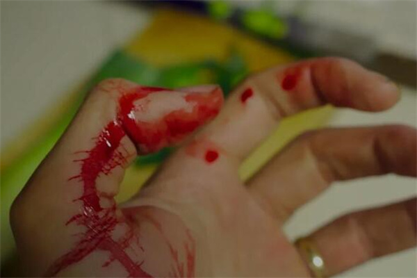 夢到血肉是好的徵兆嗎_周公解夢