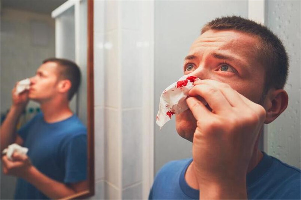 夢到了流鼻血是吉兆嗎?_周公解夢