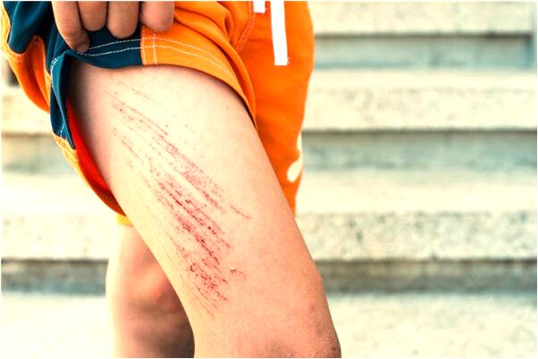 夢到了被賊偷家中戒指好不好_周公解夢官網