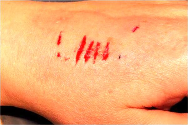 夢見親人割豬肉啥意思_周公解夢官網